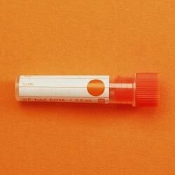 LP Italiana L113317 KF+Na2 EDTA, 2,5 ml, 12x51 mm  Ambalaj: 1800 Ad.